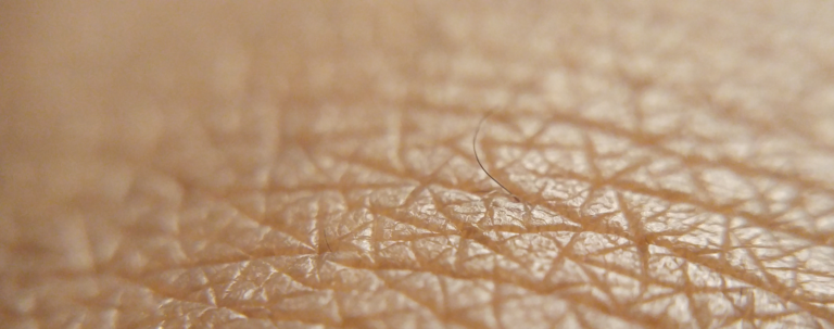 Skóra w trybie obronnym